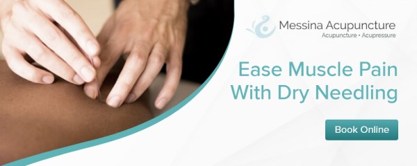 Messina Acupuncture